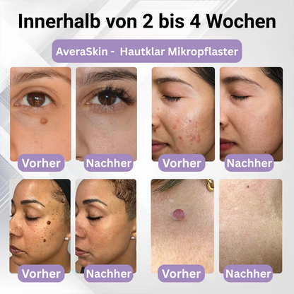 AveraSkin -  Hautklar Mikropflaster